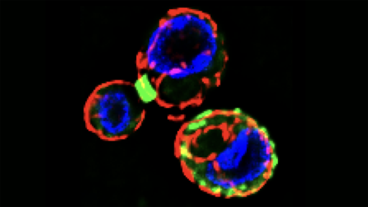 Septins-Autophagy